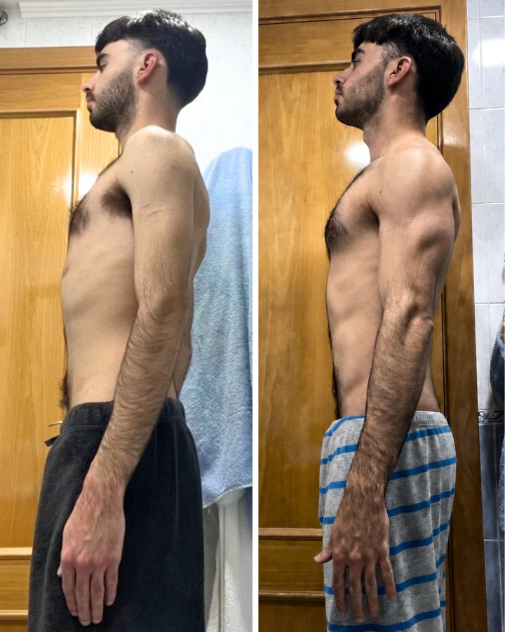 Cambio físico de Nacho: antes y después